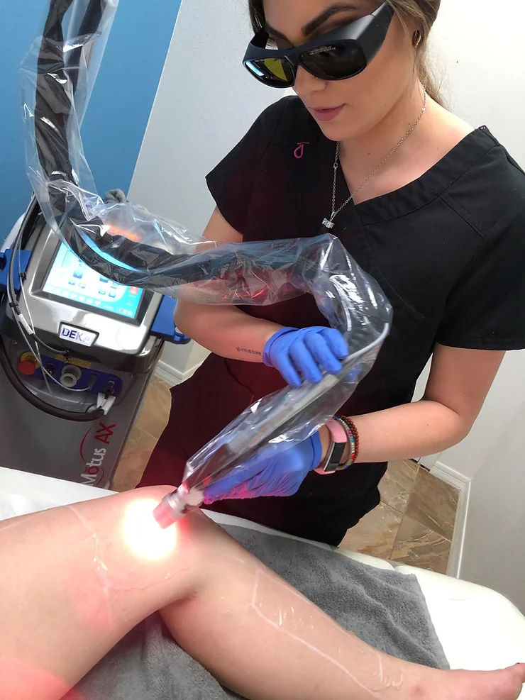 Motus AX Laser!